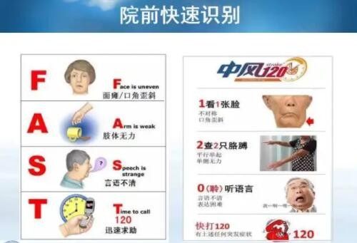 如何快速识别脑卒中？世界卒中日主题宣传活动启动