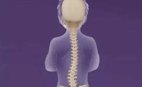 如何避免脊柱侧弯？正脊护椎让孩子少走“弯”路